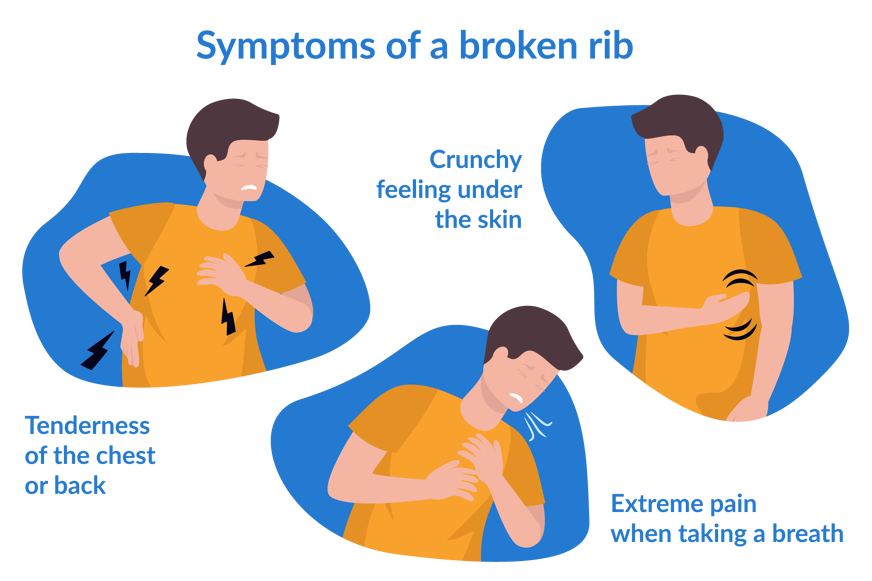 symptoms of a broken rib